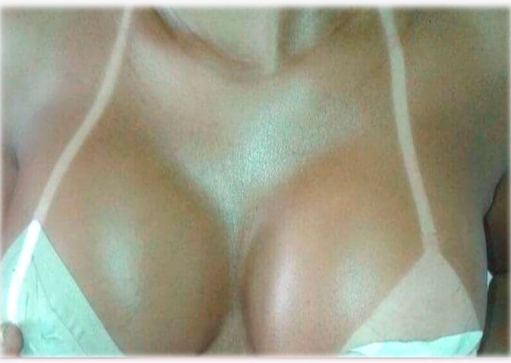 Resultado do bronzeamento a jato (Crédito: Divulgação)
