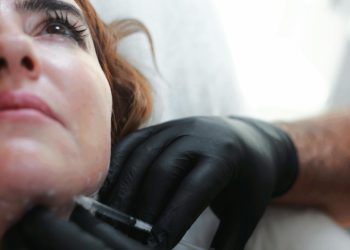 Harmonização Facial: é possível garantir resultados naturais com segurança?