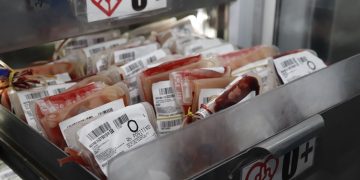 Após o São João, Hemope alerta para a necessidade de doações de sangue em Caruaru